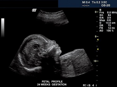 semana 24_2