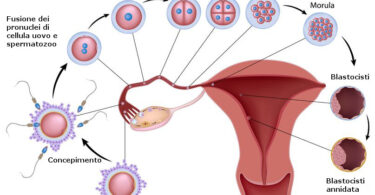 implanto nidacion