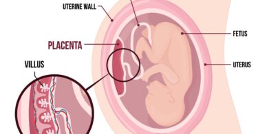 placenta anterior