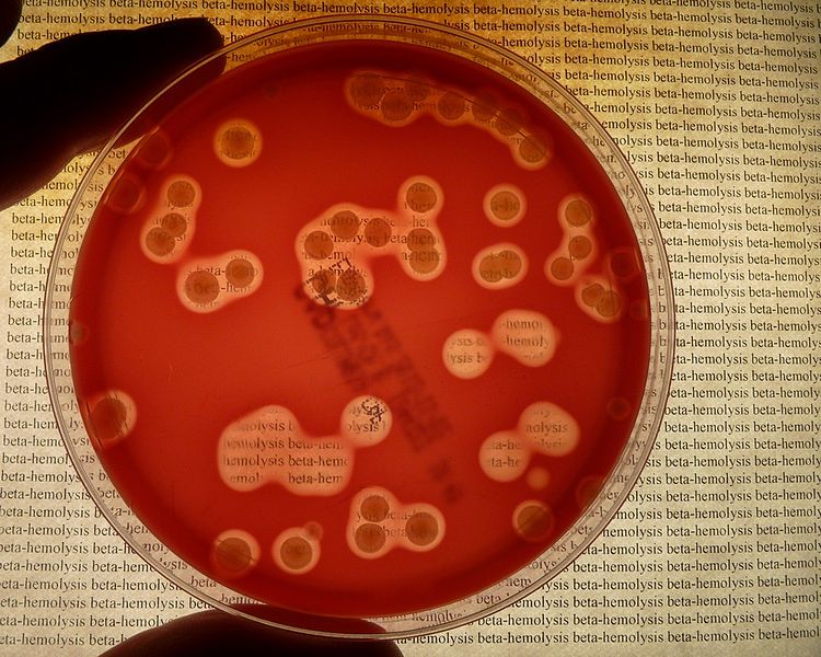 Prueba bacteria 2025 embarazo