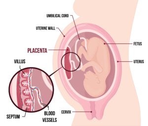 placenta anterior