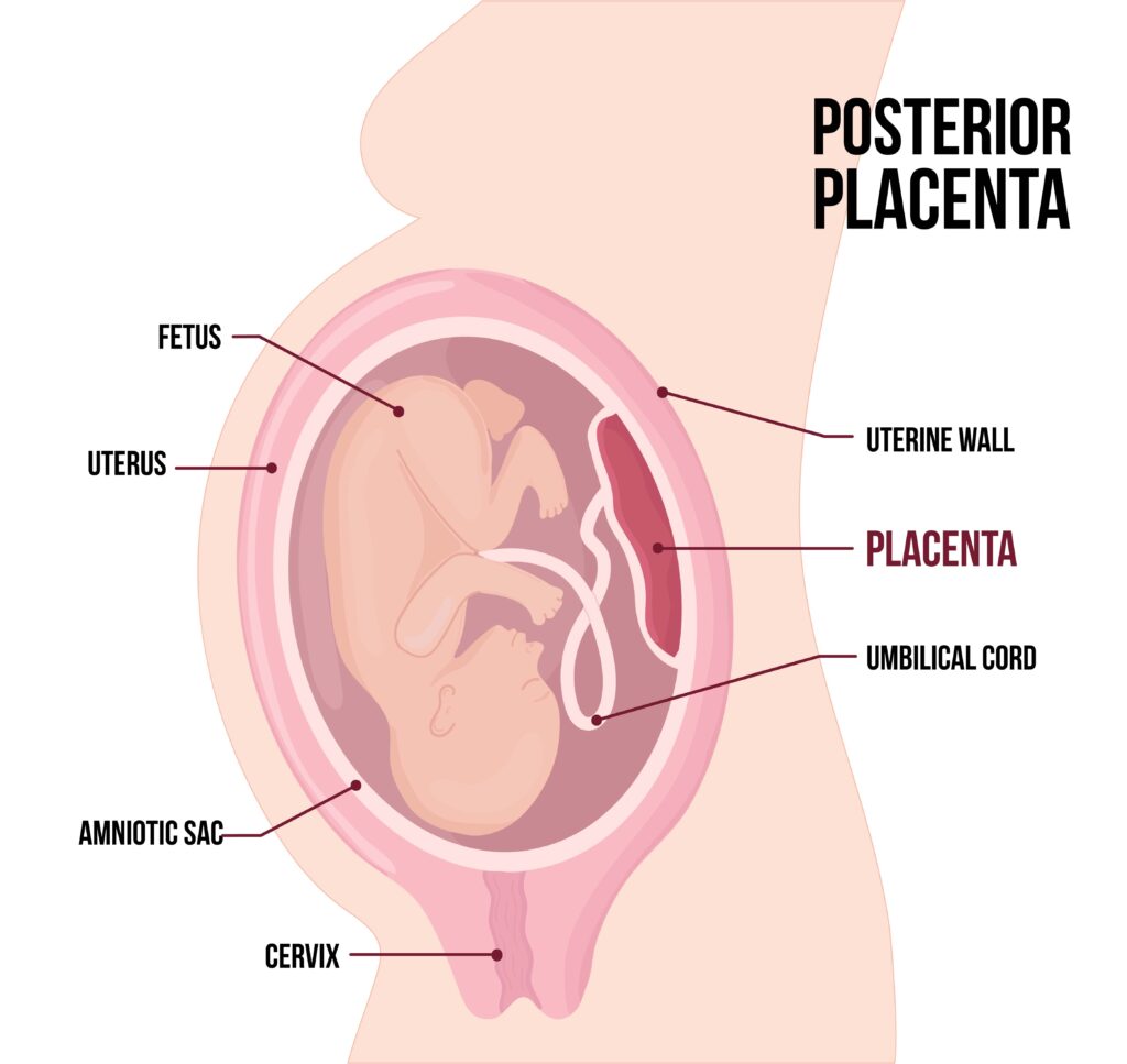 Posiciones de la placenta